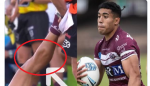 NRLSC 2022 RD5 Koula injury.png